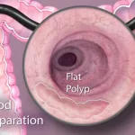 Do You Need to Be Make Up Free for Colonoscopy?