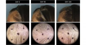 Does Nutrafol Work for Seniors Over 50?