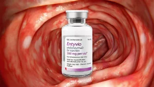 Entyvio Vedolizumab Treatment for Ulcerative Colitis Patients: How Real Relief Feels Entyvio Vedolizumab Treatment for Ulcerative Colitis Patients: How Real Relief Feels