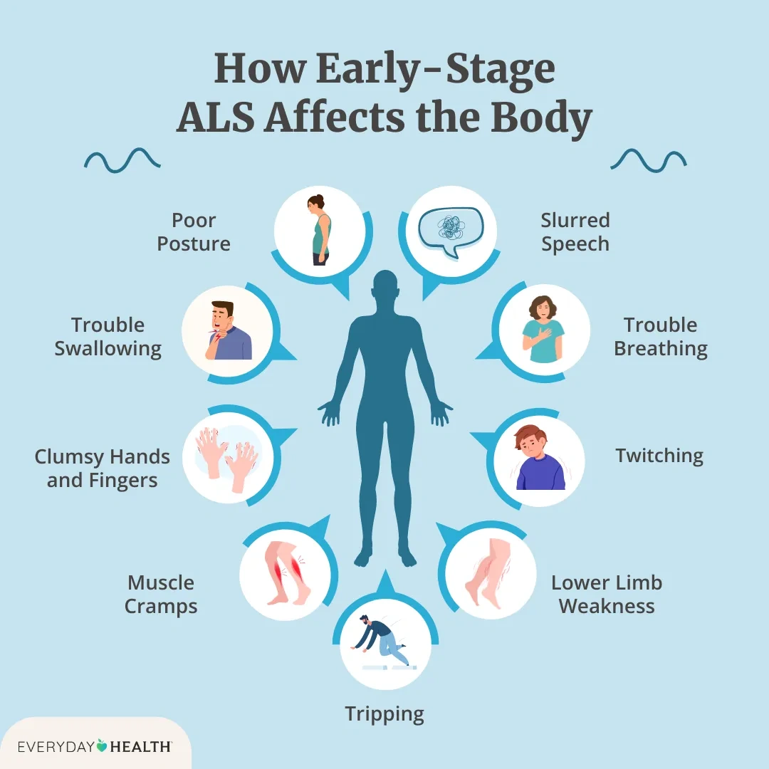 First Sign of ALS in Women: Noticing the Quiet Changes