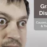 Graves' Disease Ruined My Life: Raw Story