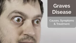 Graves’ Disease Ruined My Life: The Truth No One Tells You Graves’ Disease Ruined My Life: The Truth No One Tells You