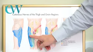 Gun Belt Syndrome: Hidden Pain for Officers