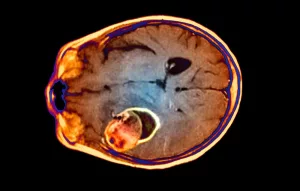 Head Feels Weird But Not a Headache: Why You Shouldn’t Ignore That “Off” Feeling Head Feels Weird But Not a Headache: Why You Shouldn’t Ignore That “Off” Feeling