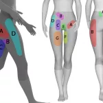 Hip Pain Location Chart: Quick Guide