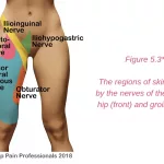 Hip Pain Location Diagram Female Guide