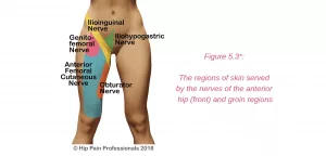 Hip Pain Location Diagram Female: Find Your Real Pain Spot