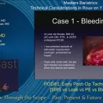How Long Does Postoperative Tachycardia Last?