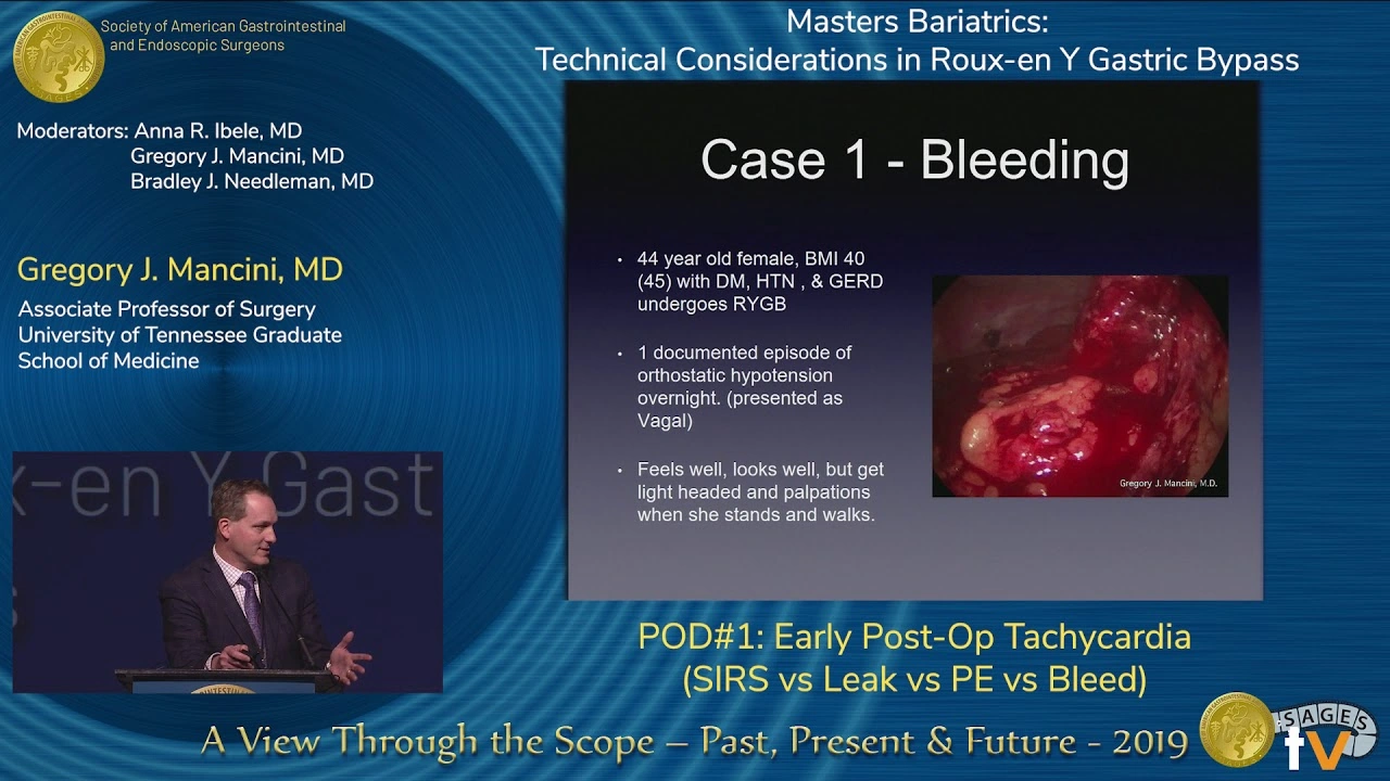 How Long Does Postoperative Tachycardia Last? Insights, Stories, and Heartfelt Advice