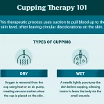 How Often Can You Get Cupping Done Safely?