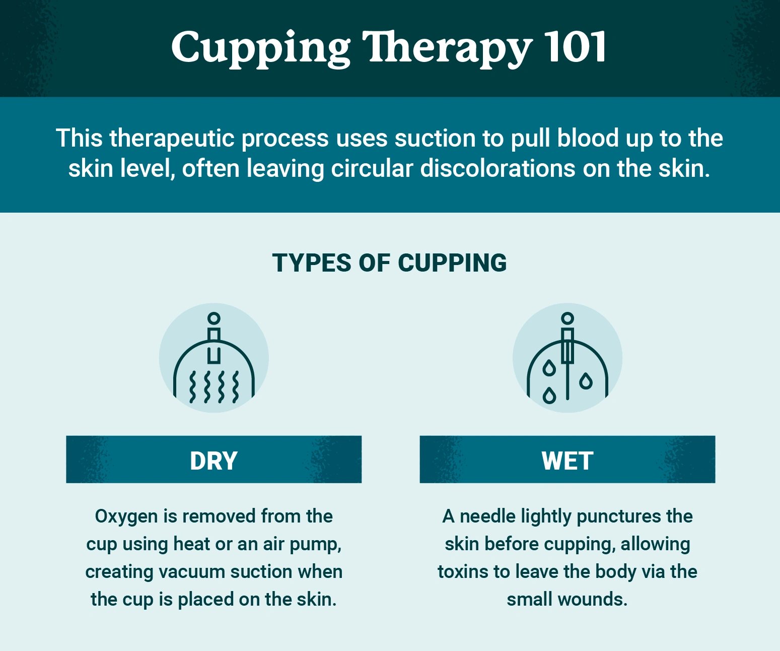 How Often Can You Get Cupping Done? (Without Going Overboard!)