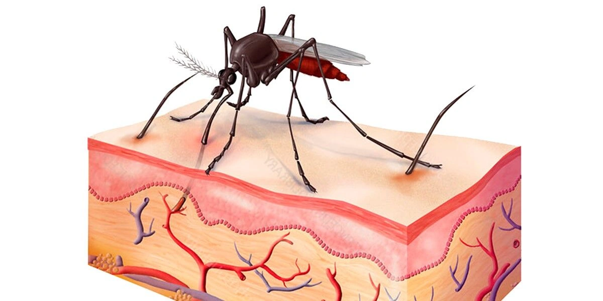 How to Bite a Mosquito Back AI: Smart, Natural Ways To Stop Being Their Snack