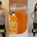 How to Take Apple Cider Vinegar for Nerve Pain