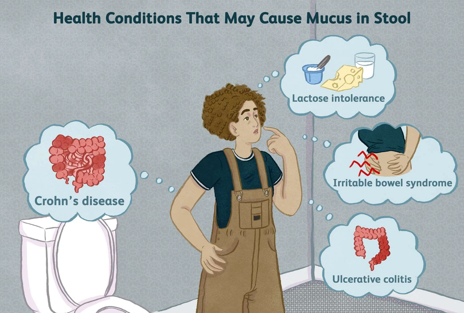 How to Treat Stool With White Mucus: Real Talk On Gut Surprises