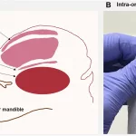 Injection Causes Spark in Tongue: Why It Happens