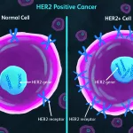 Is HER2-Positive Breast Cancer a Death Sentence?