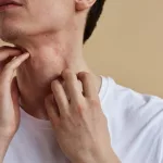 Is Nair Safe for Scalp? Risks and Tips