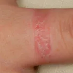 Why Is My Itchy Ring Finger Left Hand Acting Up? Let’s Get Real Why Is My Itchy Ring Finger Left Hand Acting Up? Let’s Get Real