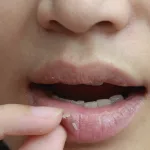 Lip Irritation from Spicy Food: Causes & Relief