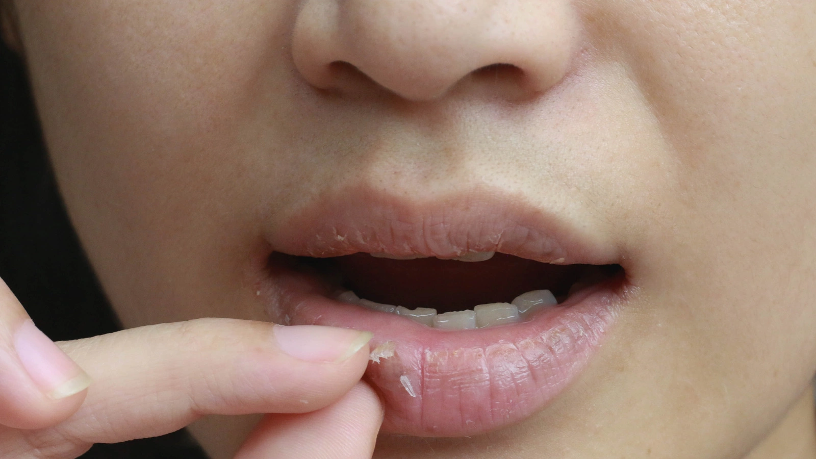 Lip Irritation from Spicy Food: Why Your Favorite Heat Hurts (and What to Do About It)