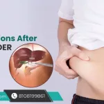 Long-term Effects of Gallbladder Removal Guide