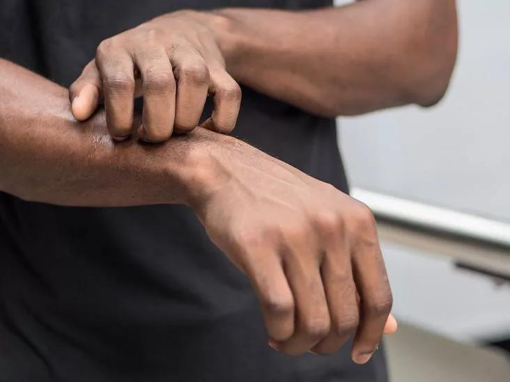 Pityriasis Rosea vs Ringworm – Spot the Difference