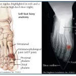 All About the Metatarsophalangeal Joint: When Your Big Toe Won’t Budge