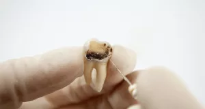 My Dentist Hit a Nerve: How Long to Get Better Naturally?