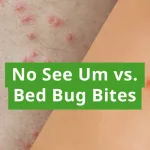 No See Um Bites: Itch Relief & Prevention