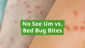 No See Um Bites: The Tiny Pests Ruining Your Peace (And How to Outsmart Them) No See Um Bites: The Tiny Pests Ruining Your Peace (And How to Outsmart Them)