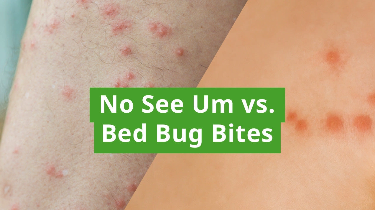 No See Um Bites: The Tiny Pests Ruining Your Peace (And How to Outsmart Them)