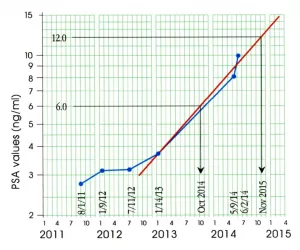 Normal PSA Velocity Chart: The Numbers That Actually Matter For You