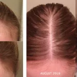 Nutrafol Bad Reviews: Real User Gripes