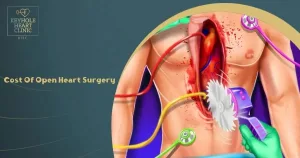 Open Heart Surgery Cost: Real Talk on What You’ll Actually Pay