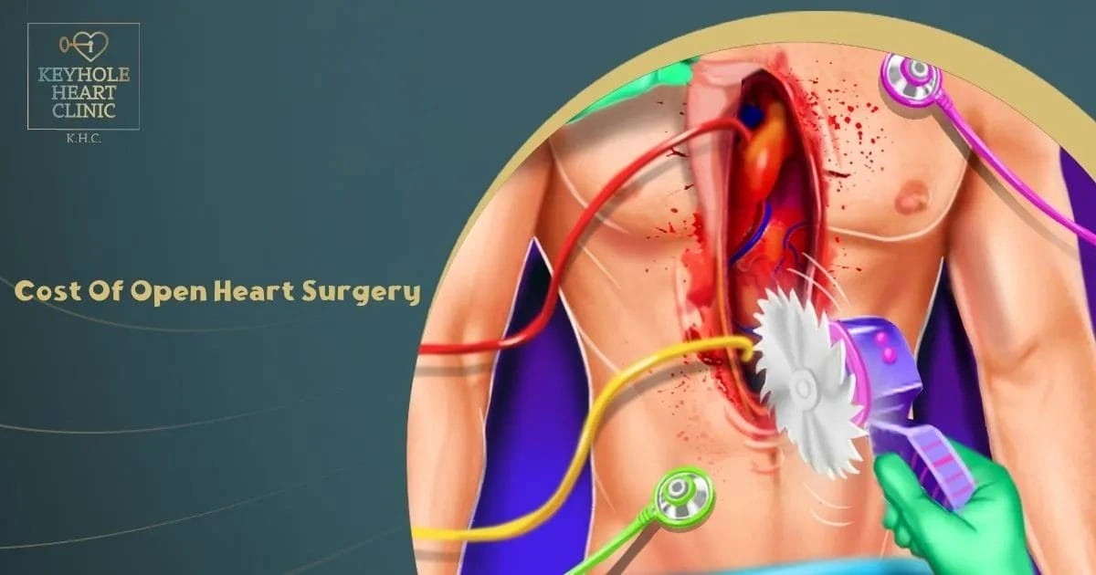 Open Heart Surgery Cost: Real Talk on What You’ll Actually Pay