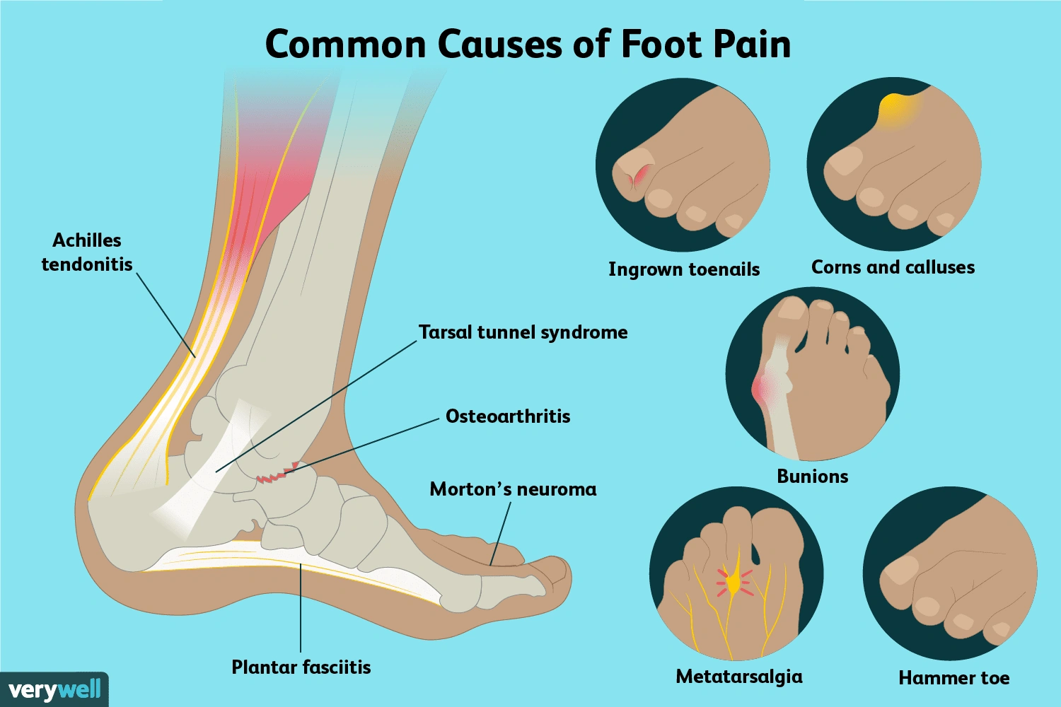 Let’s Talk About Parts of the Foot: The Unsung Heroes Down Below