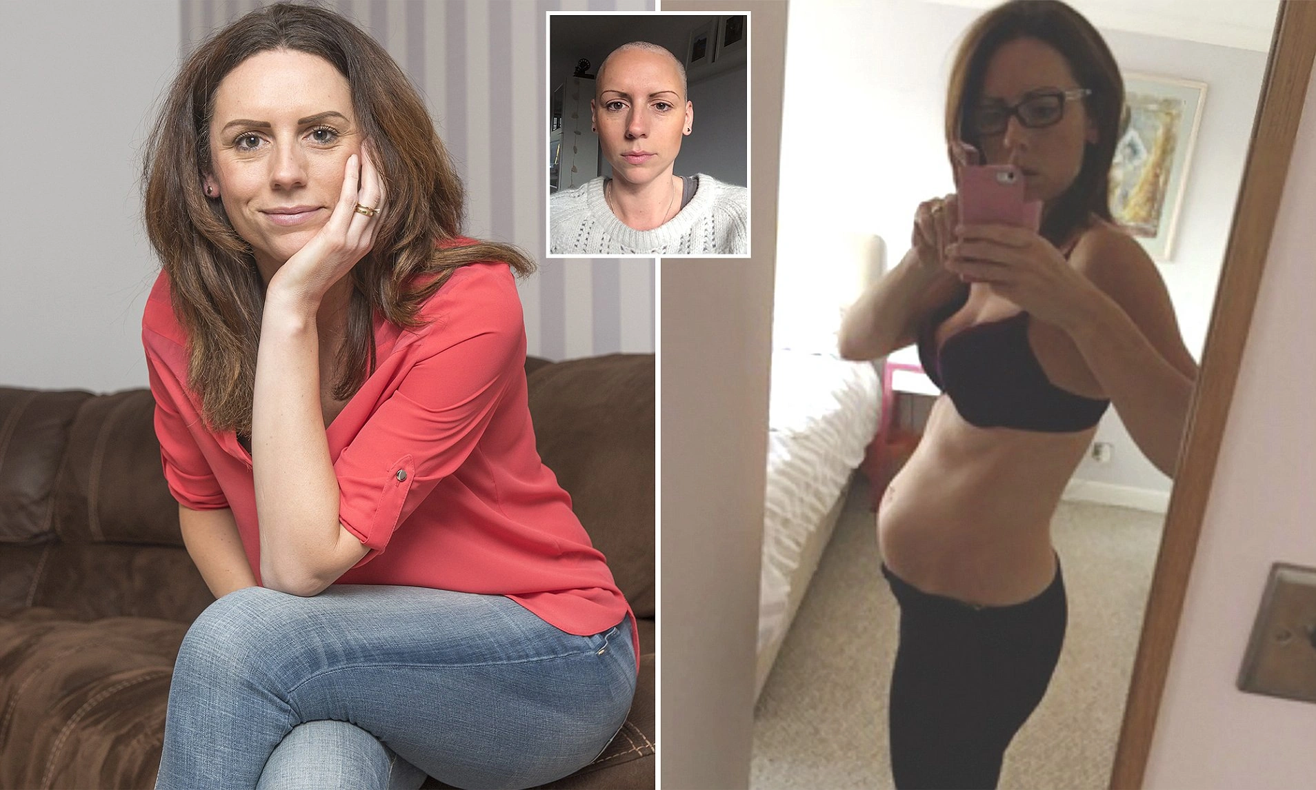 Pictures of Bloated Stomach Ovarian Cancer – What Every Woman Should Know