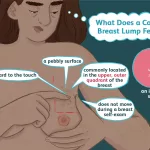 See Pictures of Breast Cancer Lumps