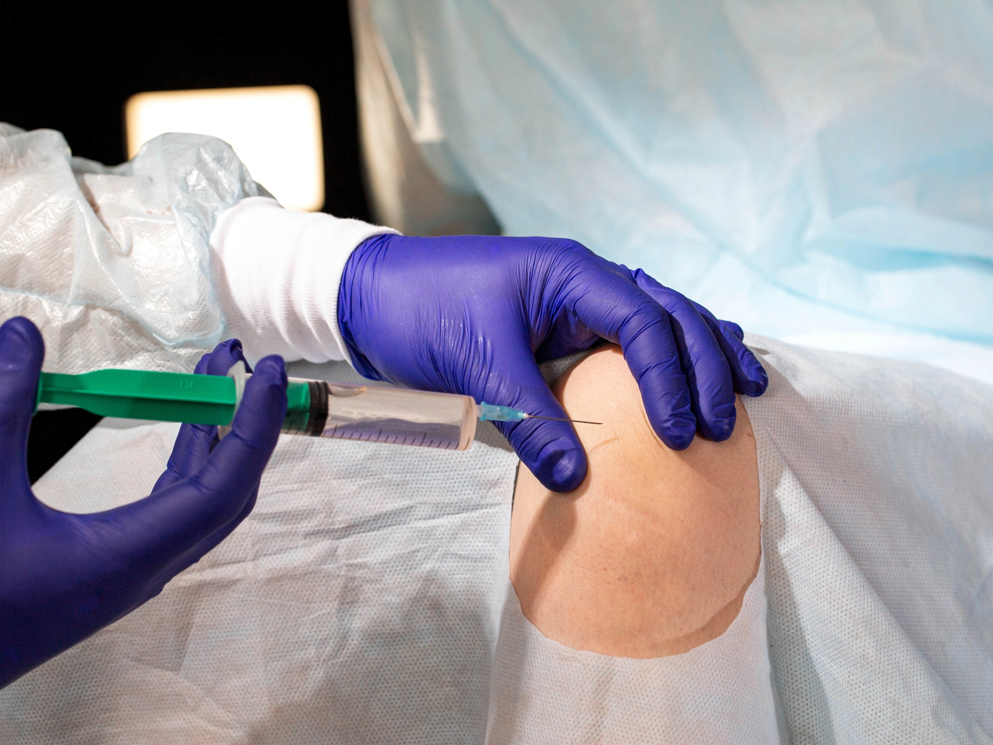 Pros and Cons of Knee Gel Injections: Is Relief Worth It?