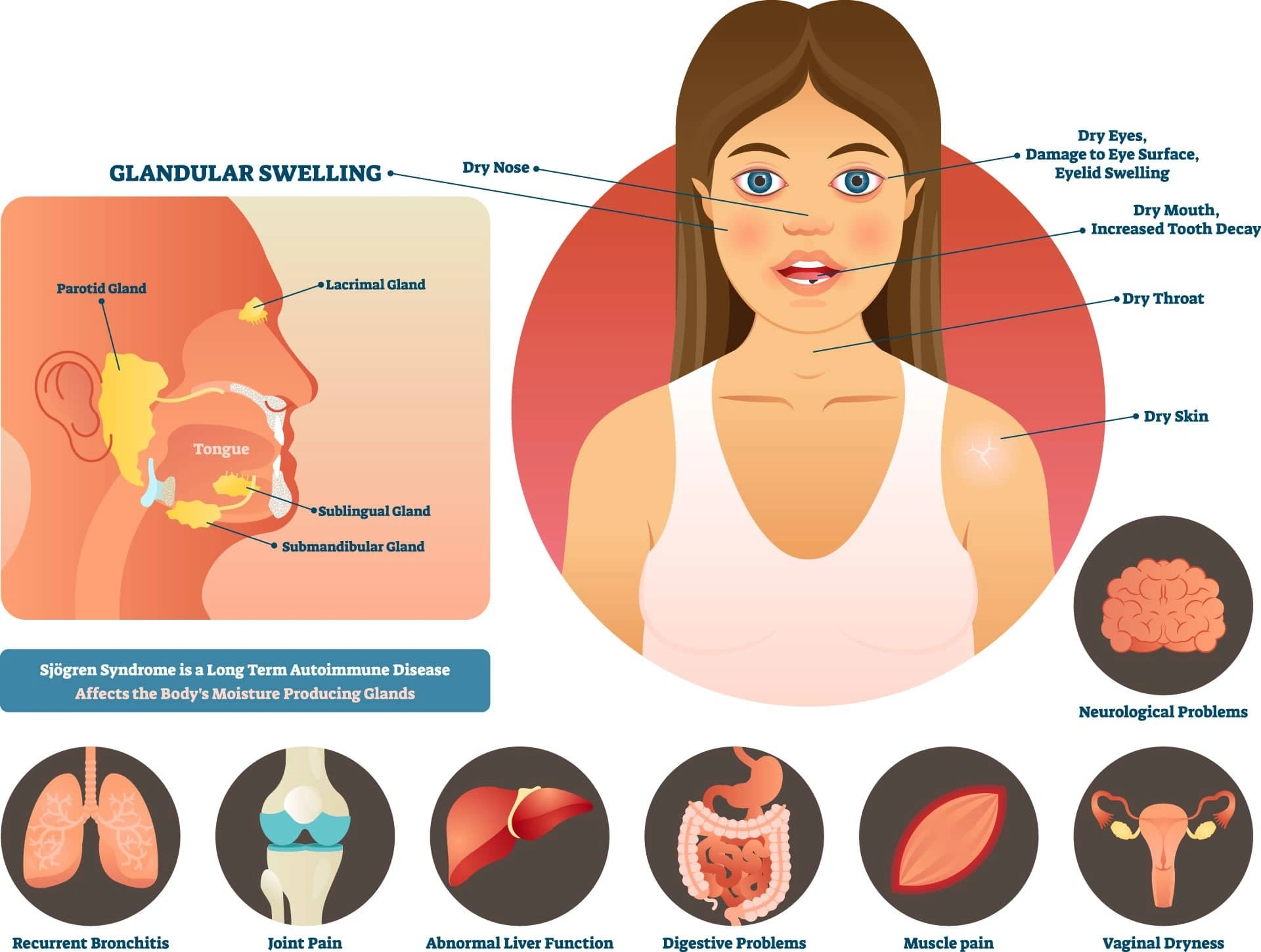 Questions to Ask Rheumatologist About Sjogren’s Syndrome: What Matters Most
