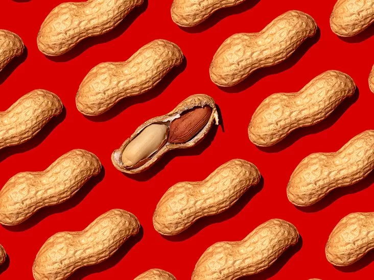 Adult Peanut Allergy: What You Need to Know Today