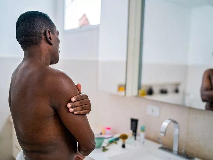 Shingles Scar Prevention: Fast Tips for Clear Skin