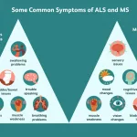 Reassuring Signs You Don't Have ALS