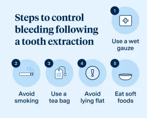Stop Blood Thinner Before Removing Tooth? Let’s Have a Real Talk Stop Blood Thinner Before Removing Tooth? Let’s Have a Real Talk