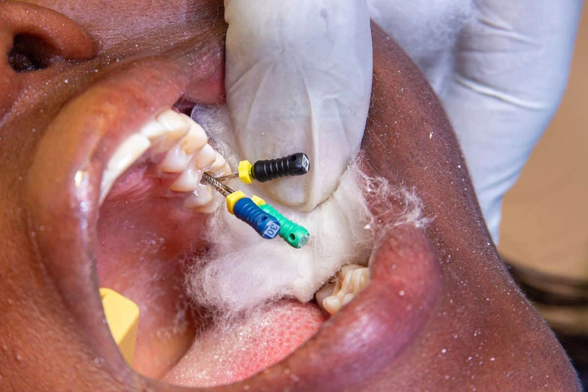 Symptoms of Nerve Damage After Dental Injection: What’s Normal, What’s Not?