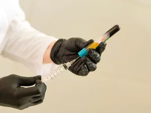 Platelet‑Rich Plasma Preparation: Simple Step‑by‑Step Guide