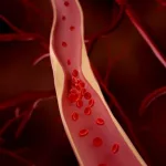 The Smoke Can Take Marijuana Could Cause Blood Clots