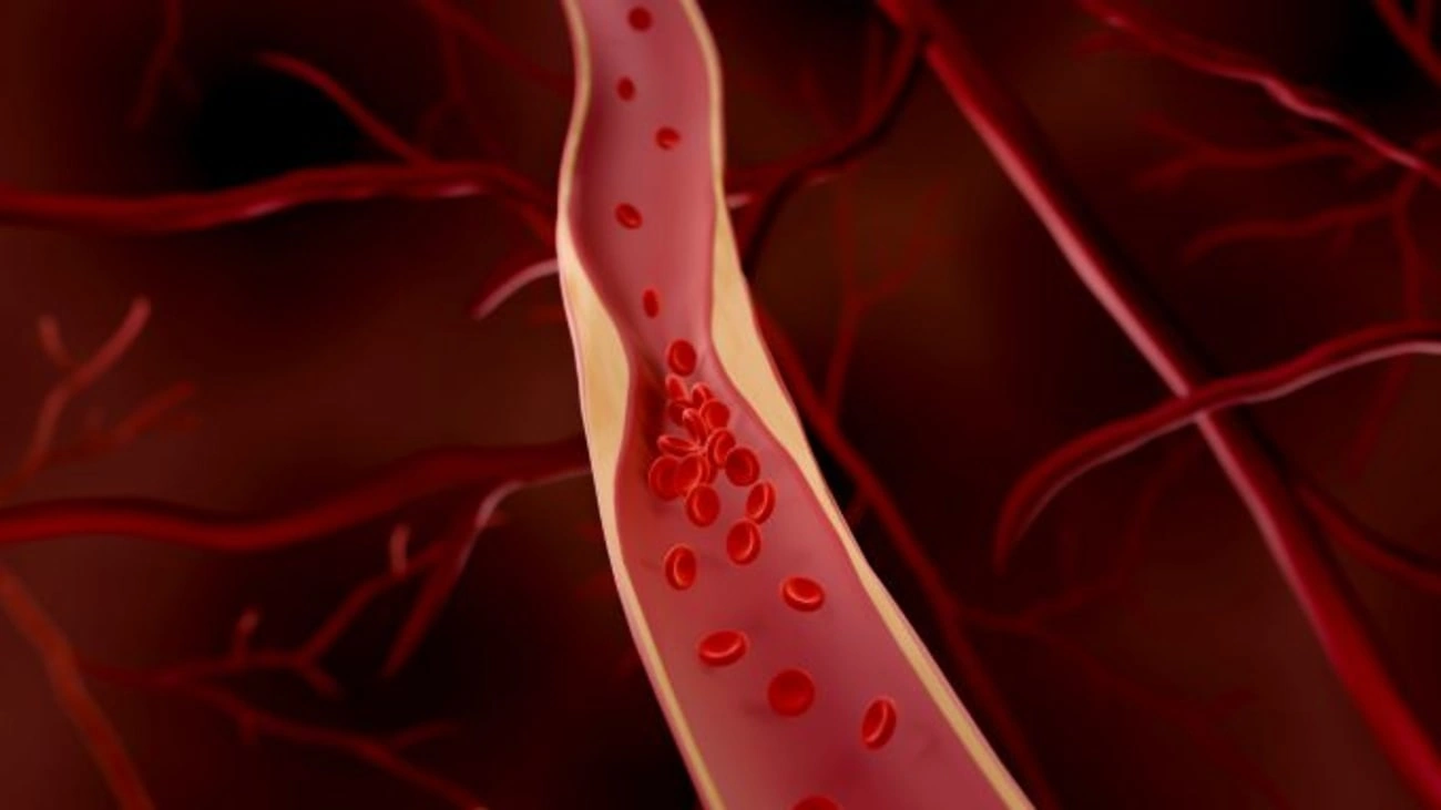 The Smoke Can Take Marijuana Could Cause Blood Clots: Let’s Talk Risks (and Real Life)