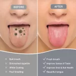 Tongue Scraping for Gut Health Boost