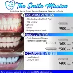 Veneers Cost Per Tooth: 2025 Prices Guide